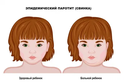 Чем болеют дети в детском саду: инфекционные болезни, их симптомы и  профилактика