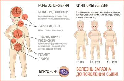 Краснуха у детей - классификация, причины возникновения и методы лечения