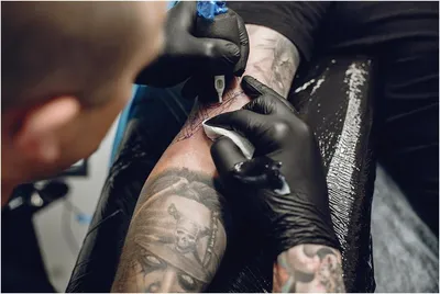 Удаление татуировок в Екатеринбурге, цены лазерное удаление тату | Клиника  \"Шанталь\"