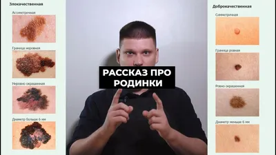 Тату на родинках