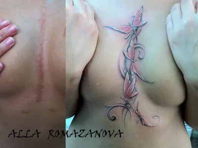 Тату на шрамах - сделать татуировку в Москве, цены