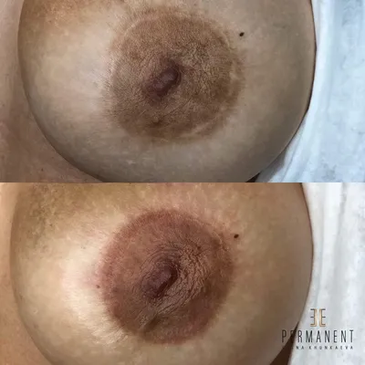 🌸Перманент ареолы сосков - Permanent nipple areola - YouTube