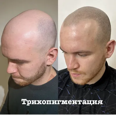 Татуаж бороды в Москве: 48 мастеров татуажа со средним рейтингом 4.9 с  отзывами и ценами на Яндекс Услугах.