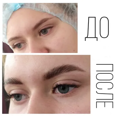 УДАЛЕНИЕ ТАТУАЖА ТАТУ ～ ПЕРМАНЕНТ ИРКУТСК (@strekalovskaya_brows) •  Instagram photos and videos