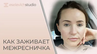 Жизнь после татуажа: как ухаживать, чтобы красота радовала вас долгое время