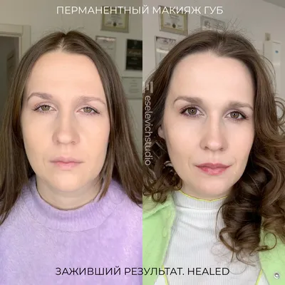 Татуаж бровей при алопеции, цена в Новосибирске, сделать перманентный  макияж при отсутствии волос