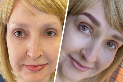 Удаление перманентного макияжа: сколько стоит, как убрать ремувером и  лазером
