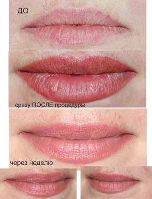 Побочные эффекты: что может произойти после перманентного макияжа? -  pro.bhub.com.ua