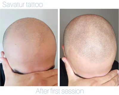 Трихопигментация волос головы мужчин и женщин в Санкт-Петербурге — Цены на  татуаж с имитацией волос, отзывы