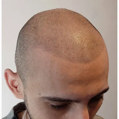 Трихопигментация волос (татуаж головы) в Самаре — 34 мастера татуажа, 4  отзыва, цены и рейтинг на Профи