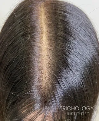 Трихопигментация волос: перманентный макияж головы в Праге
