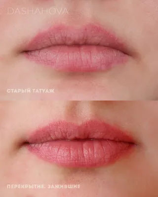 Фото перманентного макияжа губ от косметологов салона