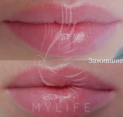 Dragonfly Studio - Перманентный макияж/татуаж губ 👄 ⠀ 💕Мастер: Алеся  (Работы мастера можно посмотреть ➡️ #Алеся_dragonflystudio) ⠀ 💶Стоимость:  6 000₽ ⠀ 💎Техника: Полное заполнение цветом «Натюрэль» (сразу после  процедуры) ⠀ 👌🏻Подчёркивает ...