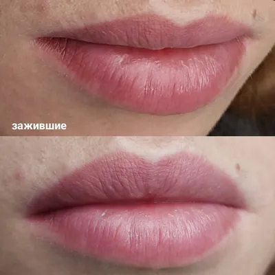 Татуаж губ в Киеве, приятная цена, 100% позитивных отзывов - Студия  перманентного макияжа Татьяны Герасимчук на Олимпийской