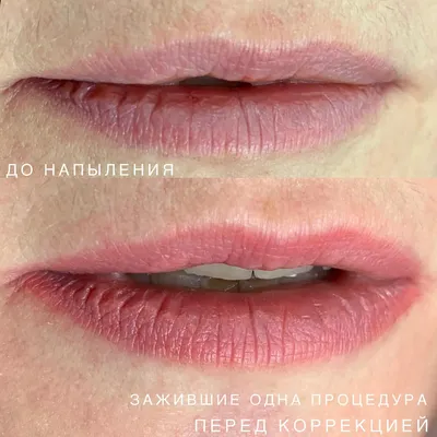 Перманентный макияж.Татуаж.Киев - Еще одни ЗАЖИВШИЕ губки Nude  Blush🏆🏆🏆🏆🏆🏆🏆🏆🏆🏆🏆🏆🏆🏆🏆🏆🏆🏆🏆🏆 Реставрация красной каймы губ(  природного контура) с помощью техники перманентного макияжа Nude Blush💋 .  Перманентный макияж( татуаж) губ ...