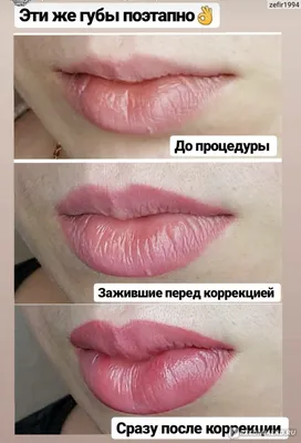 Татуаж Туапсе - 👄Сексуальность на виду...👄 ⠀ 💄Это я про губы которые  всегда выражают женскую сексуальность🥰 ⠀ 🍭Процесс заживления  перманентного макияжа губ ⠀ 💫Процедура перманентного макияжа(татуажа)  сложный процесс. ⠀ 📢 Собираясь на