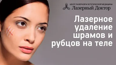 Удаление шрамов и рубцов | Damas Medical Center