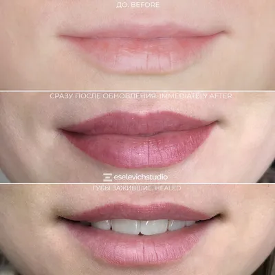 Перманент на тонкие губы до и после (71 фото) - картинки modnica.club