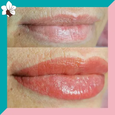 Permanent MakeUp Croatia - Очень круто, когда две процедуры делаются в  тандеме. Татуаж ➡️ Увеличение губ ➡️ Коррекция татуажа. Немного о грустном  - на маленьких губах желаемого эффекта не будет НИКОГДА!!! Они