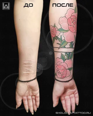18 идей татуировок, которыми можно красиво закрыть шрамы