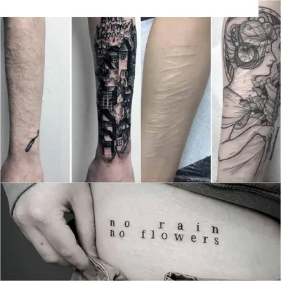 Тату на шраме от аппендицита фото – примеры готовых татуировок