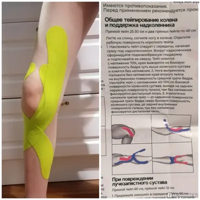 MST Company Ltd. / Компания Медико-Социальных Технологий - Medical Taping