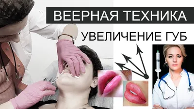 dr.davinci_ - 👄КОНТУРНАЯ ПЛАСТИКА ГУБ👄. 💋РУССКАЯ ТЕХНИКА УВЕЛИЧЕНИЯ ГУБ💋.  Техника @emelianbraude @emelianbraude_ . 💯В работе я использую только  оригинальные и самые качественные косметологические препараты и расходные  материалы.💯. ☝️Губы сразу ...