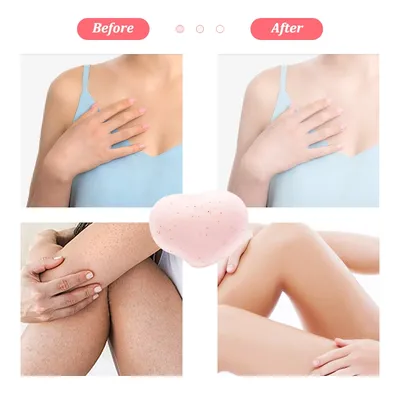 Aziza Ulugbekovna on Instagram: \"Aziza Ishbutayeva: Интимный пилинг  (отбеливание) подмышек Есть ряд причин, из-за которых кожа в подмышечной  области темнеет: реакция на средство от пота или другую косметику с  агрессивными компонентами, гормональный