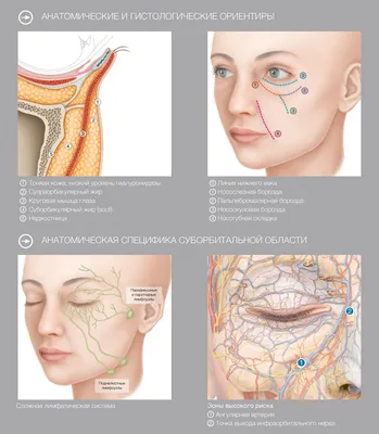 КОСМЕТОЛОГИЯ ТАМБОВ on Instagram: \"🔷Коррекция носослезной борозды  🔷Препарат Теосиаль Реденсити 2 Даже молодой женщине углубленная  носослезная борозда может придать усталый и болезненный вид. ▪️Когда мы  стареем, а процесс начинается с 28 лет ,