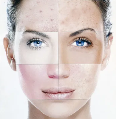 ᐉ Как определить тип кожи - все методы узнать какой у тебя тип кожи, онлайн  тест