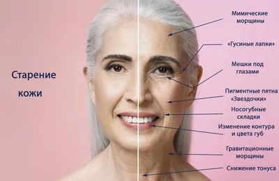 Как определить тип старения кожи? Тест. Правила ухода при разных типах  старения - Lena Chapa