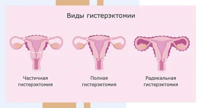 Разновидность обнаженных женских половых органов (91 фото) - порно и  эротика HuivPizde.com