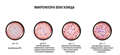 Лечение опущения и выпадения женских половых органов • Центр гинекологии в  Санкт-Петербурге