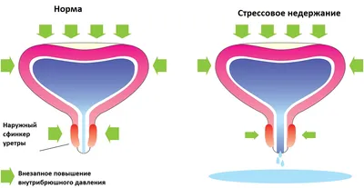 Сексологи нашли у женщин еще одну волшебную точку - Delfi RU