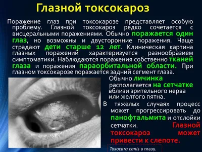 ДМК медицина лікар Галина on Instagram: \"Токсокароз в США в пятерке  инфекций, которым не уделяется достаточного внимания ⠀ Инфицированность в  развитых странах умеренного климата 1-20%, в тропических 30-85%. Яйцами  токсокар загрязнены почвы