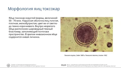 Книга О современных методиках выявления и лечения токсокароза глаз /  Устинова Е. И. - купить здравоохранения, медицины в интернет-магазинах,  цены на Мегамаркет | 9785906648631