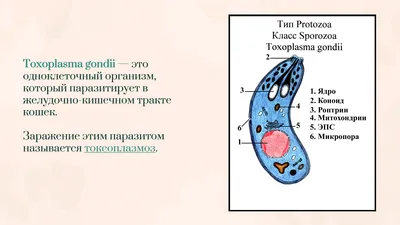 Instagram ನಲ್ಲಿ TSVORIC : \"Привет. Пришло время рассказать, я была у  офтальмолога в надежде, что в Америке мне смогут сделать операцию на мой  глаз, но к сожалению, как мне и говорили в