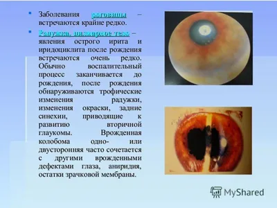 Токсоплазмоз лечение консультация в Санкт-Петербурге в медицинском центре  ID-CLINIC