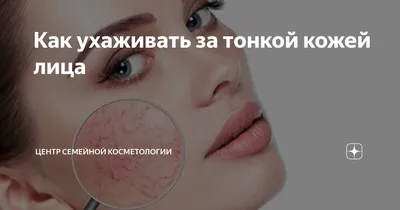 Как ухаживать за тонкой кожей лица | Центр семейной косметологии | Дзен