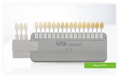 Шкала ВИТА и её использование в зубном протезировании, подробнее в статье  на сайте Denta-Labor