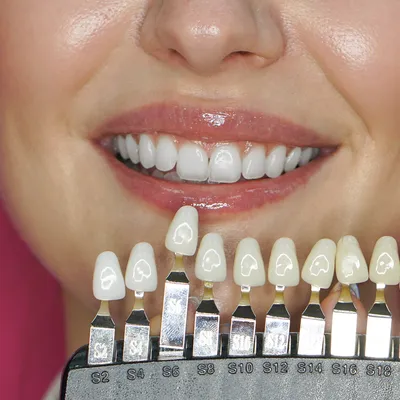 Студия косметического отбеливания зубов - Существуют три основных слагаемых  формирующих внешний вид Вашей улыбки:взаимное расположение,форма и цвет  зубов.Все они вносят существенный вклад в общий результат,но особо  пристальное внимание обращается ...