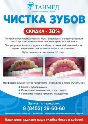 Отбеливание зубов Москва