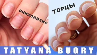 Maestro-nails - ТОРЦЫ ПИЛИТЬ ИЛИ ЗАПЕЧАТЫВАТЬ? ⠀Многие задаются вопросом:  ⁉️Запечатывать торцы или нет? ⁉️Можно ли их подпиливать? ⠀Не забудь  поставить ❤️ и сохранить полезный пост в закладки ☺️ ⠀С появлением  гель-лака у