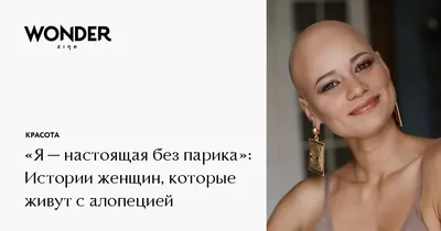 Девушка из Красноярска внезапно облысела в 13 лет и рассказала о жизни с  алопецией - 4 апреля 2023 - НГС24