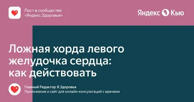 Трабекула левого желудочка: что это такое, код по мкб 10, виды, признаки,  опасна ли дополнительная трабекула, лечение