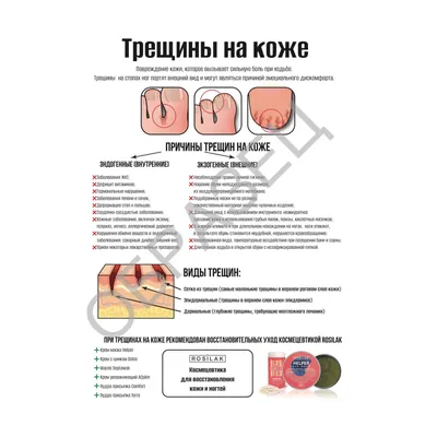 Как ухаживать за ногами после педикюра