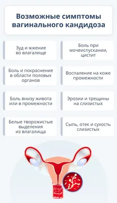 Кандидоз у женщин: симптомы и признаки, почему возникает и как проявляется?