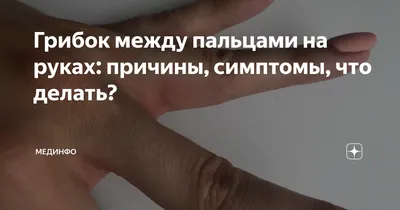 Облазит кода между пальцев ног? Так... - ФЕЯ Маникюра Киев | Facebook