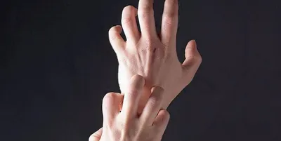 Трещины на пальцах возле ногтей: причины, лечение - Азбука здоровья