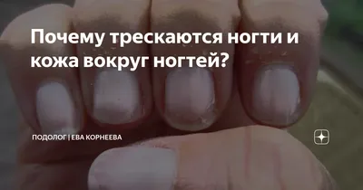 Почему трескаются ногти и кожа вокруг ногтей? | Подолог | Ева Корнеева |  Дзен